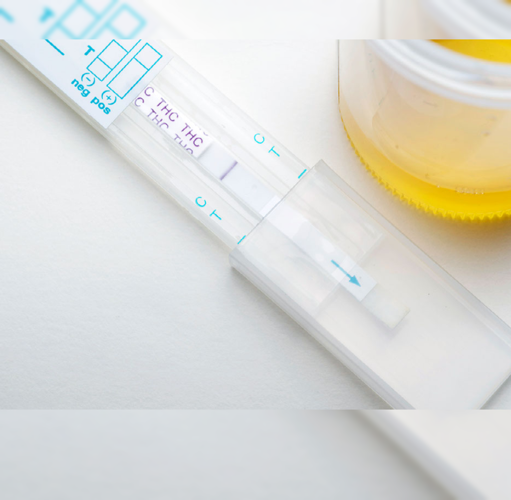 Product image for CBD TESTING STRIPS